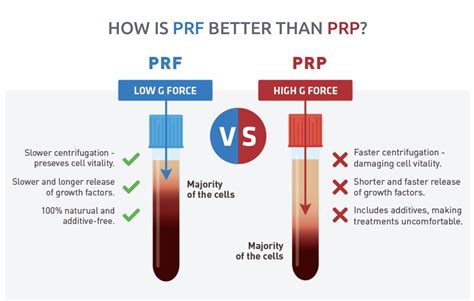 prf vs prp pubmed